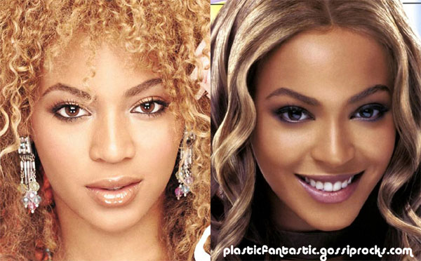 Beyonce Knowles nose job.
