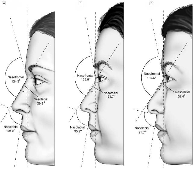 The side views of the average North American white woman (A), the attractive Korean-American woman (B) and the average Korean-American woman (C).