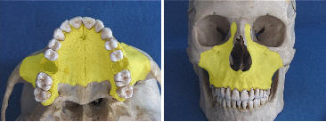 The maxillary bones.